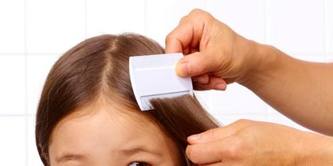 head lice