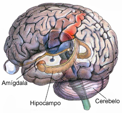 dimentia